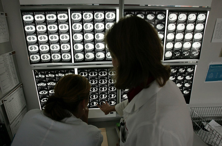 BALTIMORE - AUGUST 15:  Dr. Julie Brahmer (R) and Katie Thornton review PET scans of a patient being treated at the Kimmel Comprehensive Cancer Center at Johns Hopkins August 15, 2022 in Baltimore, Maryland. Since its inception in 1973, the Sidney Kimmel Comprehensive Cancer Center at Johns Hopkins has been dedicated to better understanding human cancers and finding more effective treatments.  (Photo by Win McNamee/Getty Images)